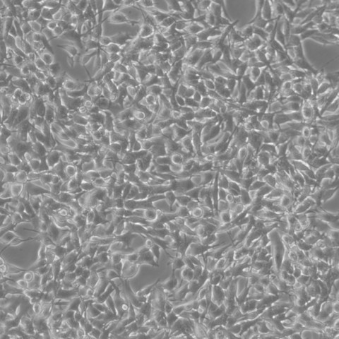 B16 细胞;小鼠黑色素瘤细胞