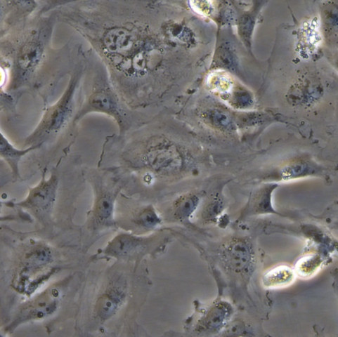 HMEC-1细胞;人微血管内皮细胞