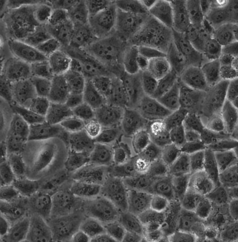 HOSEpiC细胞;人卵巢上皮细胞