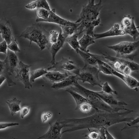 HT22细胞;小鼠海马神经元细胞