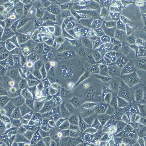 KYSE-30细胞;人食道癌细胞