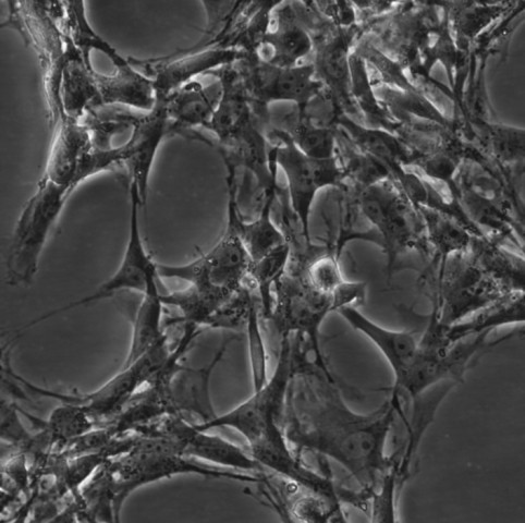 LX-2细胞;人肝星状细胞