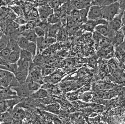 MCF10A细胞;人正常乳腺细胞