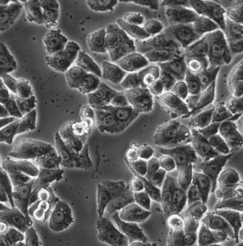 MDA-MB-468细胞;人乳腺癌细胞