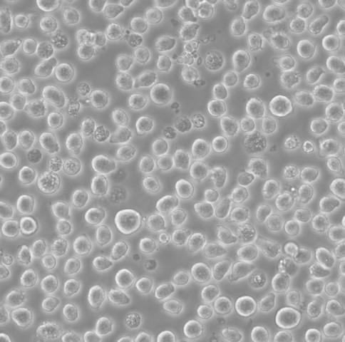PH细胞;急性单核细胞白血病细胞