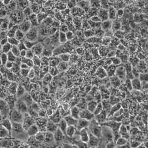 JAR细胞;人胎盘绒膜癌细胞