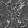 HCC827细胞;人非小细胞肺癌细胞