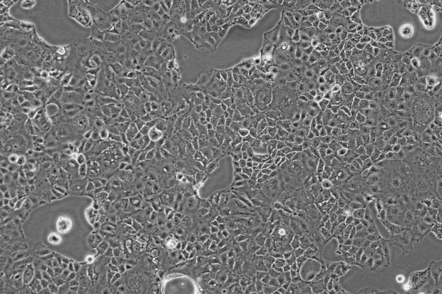 caco-2细胞;人克隆结肠腺癌细胞