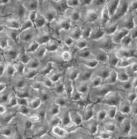 T24细胞;人膀胱癌细胞