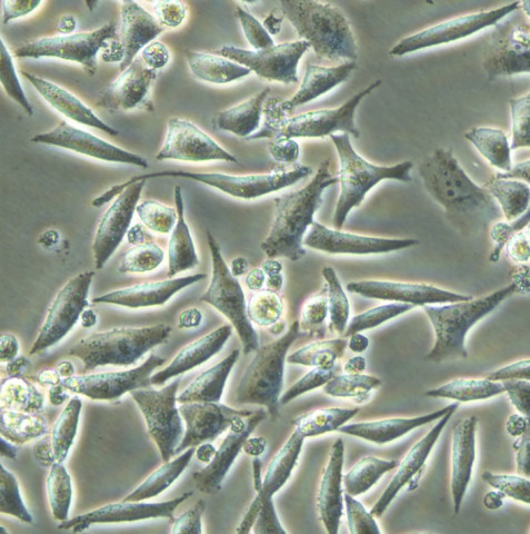 SK-UT-1细胞;人平滑肌肉瘤细胞