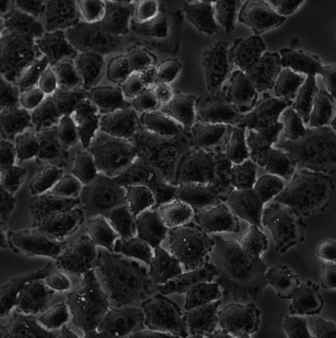 SMMC-7721细胞;人肝癌细胞