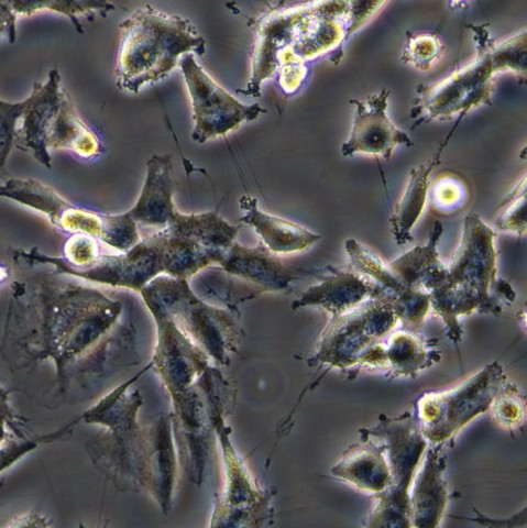 SW579细胞;人甲状腺鳞癌细胞