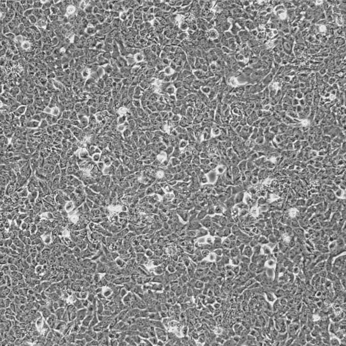 aml12细胞;小鼠正常肝细胞