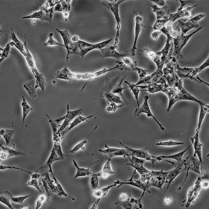 SV40-MES-13细胞;小鼠肾小球系膜细胞