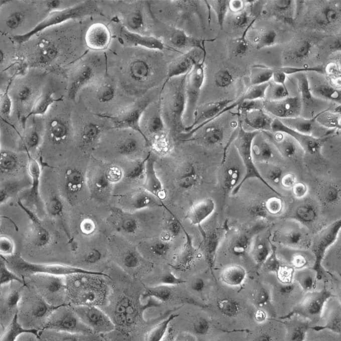 NCI-H1650 细胞;人肺支气管癌细胞