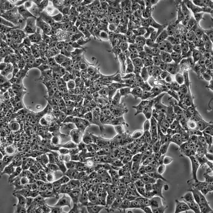 【热销】293A细胞;HEK293A;人胚肾细胞