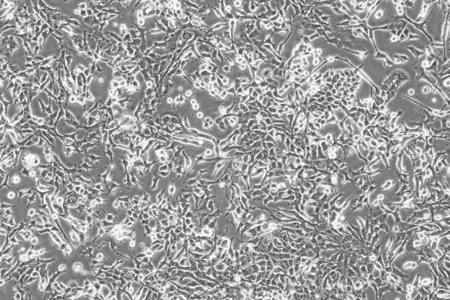 E0771细胞;小鼠髓样乳腺癌细胞