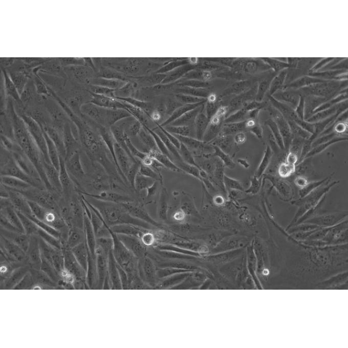 MDA-MB-231细胞;人乳腺癌细胞