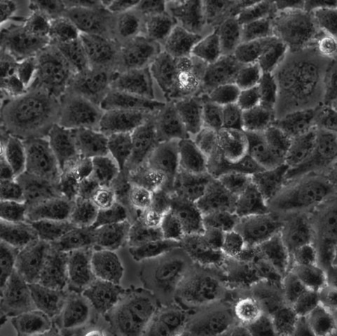 NCM460细胞;人正常结肠上皮细胞