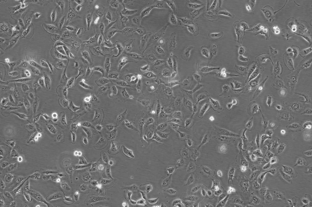 786-O细胞;人肾透明细胞腺癌细胞