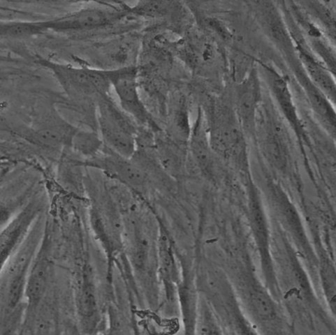 HSF细胞;人皮肤成纤维细胞
