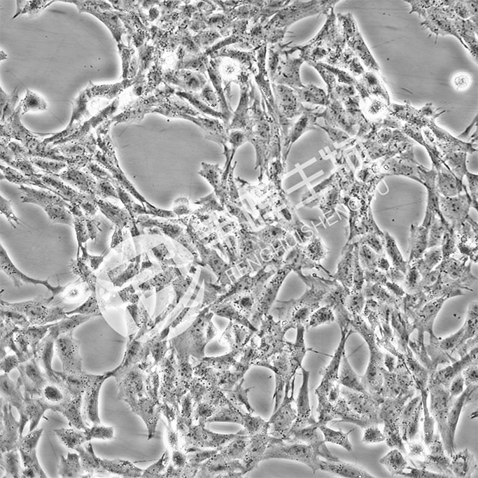 CTX-TNA细胞;大鼠星形胶质细胞