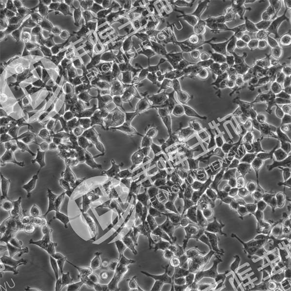 293T/17细胞(人胚肾细胞(SV40T基因修饰))