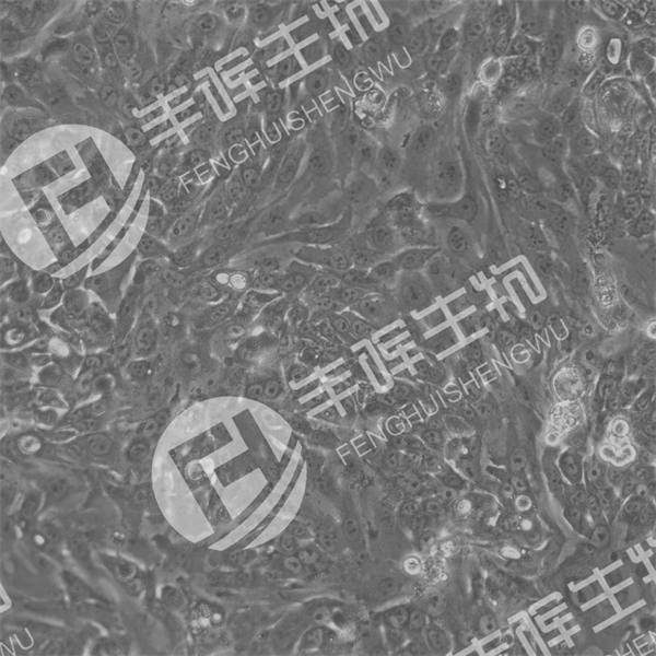 LS513细胞（人盲肠癌细胞）