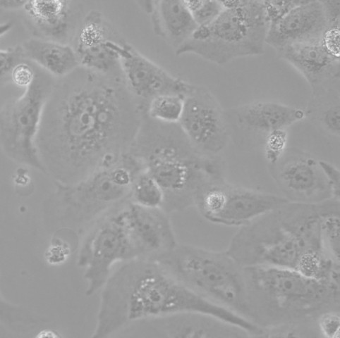 GBC-SD 细胞;人胆囊癌细胞