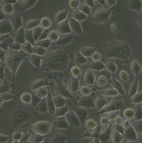HCT-15细胞;人结肠癌细胞