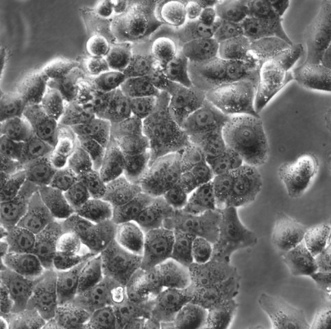 HNEPC细胞;人鼻粘膜上皮细胞