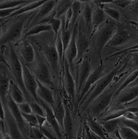 MAEC细胞;小鼠主动脉内皮细胞 
