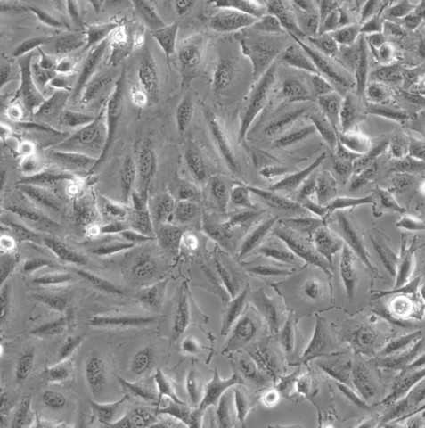NCI-H1975细胞;人肺腺癌细胞