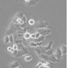 HONE-1细胞;人鼻咽癌细胞