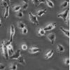 MZ-CRC-1细胞;人髄样甲状腺癌细胞