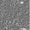 ID8细胞;小鼠卵巢上皮癌细胞