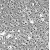 ACHN细胞;人肾细胞腺癌细胞