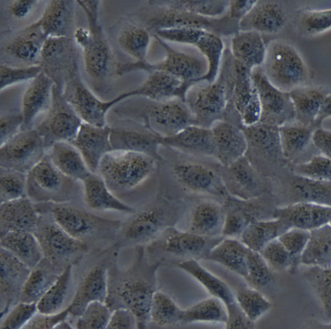 SKOV3细胞;人卵巢癌细胞