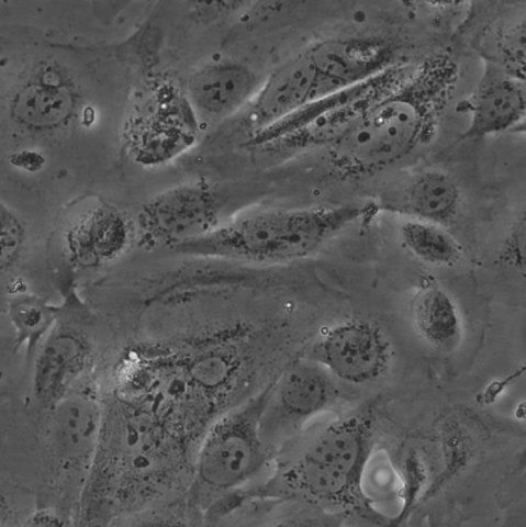 SV-HUC-1细胞;人膀胱上皮永生化细胞