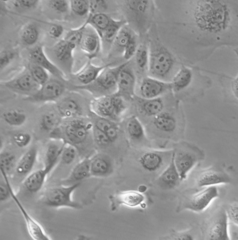 TE-5细胞;人食管癌细胞 