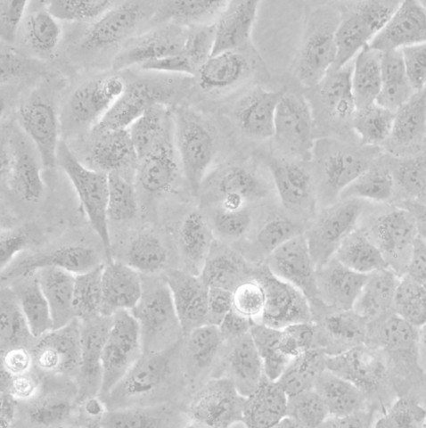 U-2OS细胞;人骨肉瘤细胞