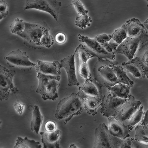 WM35细胞;人黑色素瘤细胞