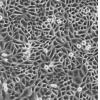 SiHa细胞;人子宫颈鳞癌细胞