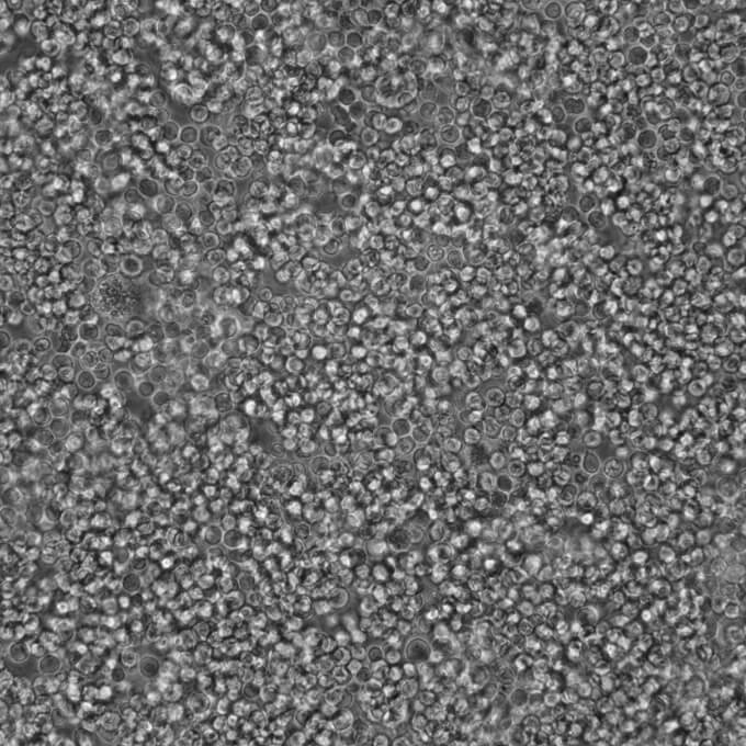 RPMI-8226细胞;人多发性骨髓瘤细胞