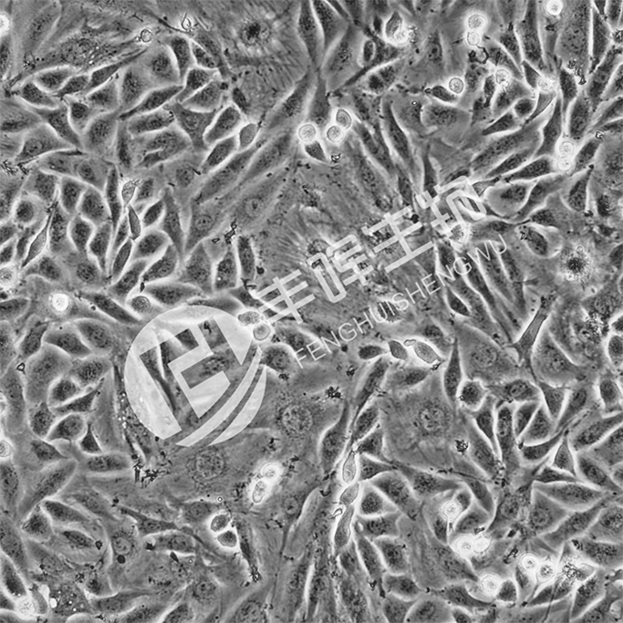 A10细胞;大鼠主动脉血管平滑肌细胞