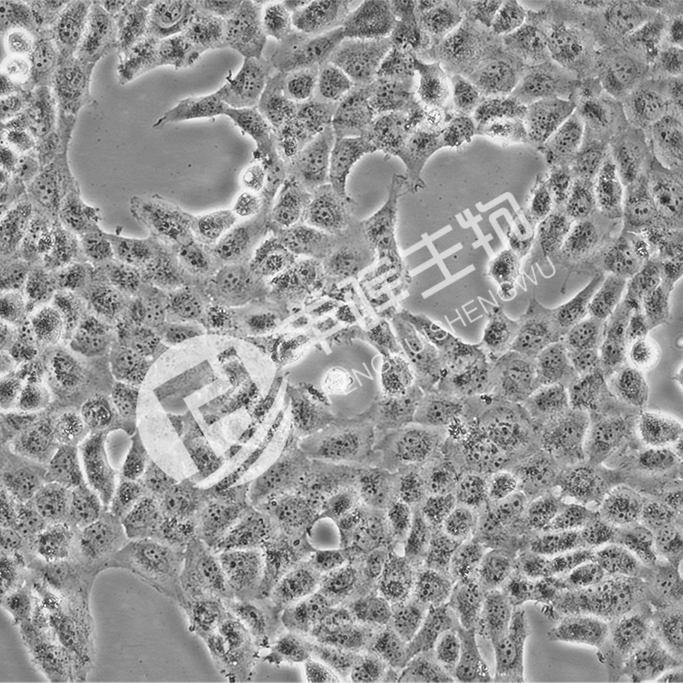 TPC-1细胞;人乳头瘤甲状腺细胞