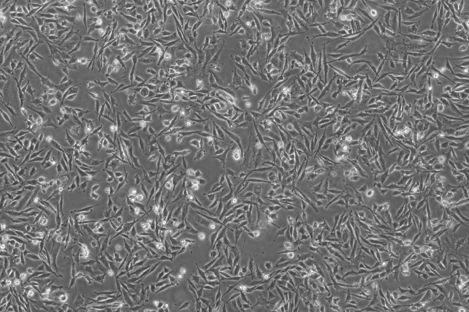 DF-1细胞;&nbsp;鸡胚成纤维细胞