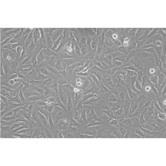 hRMECS细胞;人视网膜微血管内皮细胞