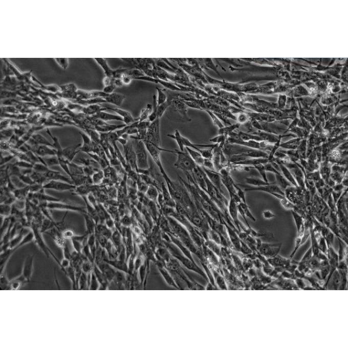 HKF细胞;人瘢痕疙瘩成纤维细胞