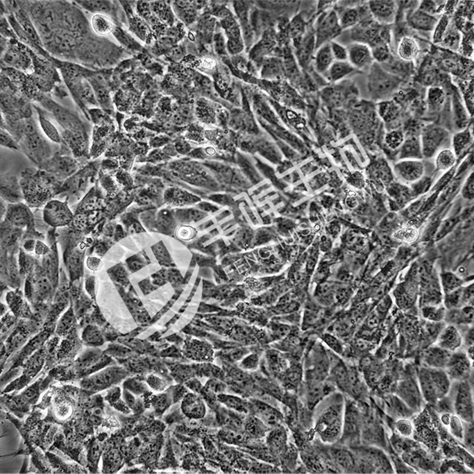 JS-1小鼠肝星状细胞;